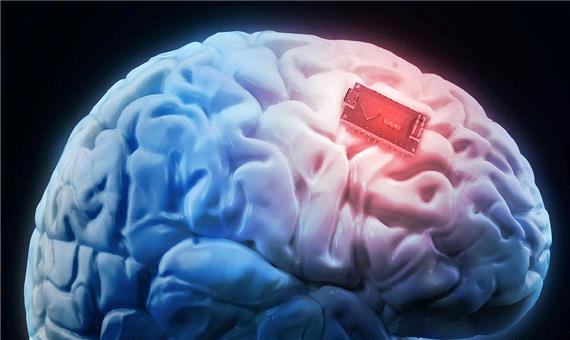 آزمایش بالینی ایمپلنت‌های مغزی به تحقق نزدیک می‌شود