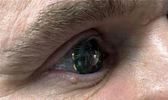 آزمایش نخستین لنز چشمی مجهز به واقعیت افزوده
