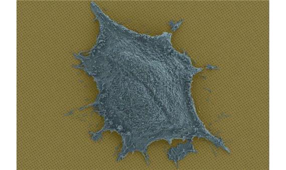 مشاهده پروتئین‌ها و آنتی بادی‌ها در سلول با استفاده از یک ابزار نانویی