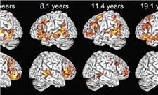 پیش‌بینی سن مغز با استفاده از روش رگرسیونی تجمیعی مبتنی بر اطلس مغزی