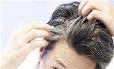 شناسایی 6 وضعیت پزشکی از ظاهر موی سر