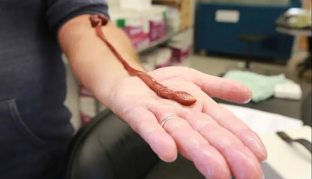 دانشمندان از سر کنجکاوی سن یک کرم آزمایشگاهی را اندازه گرفتند؛ نتیجه همه را غافلگیر کرد