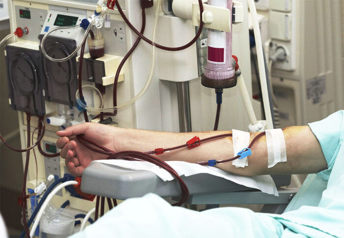 پدر فداکار بابلی برای نجات دختر هشت ساله‌اش، کلیه‌اش را اهدا کرد