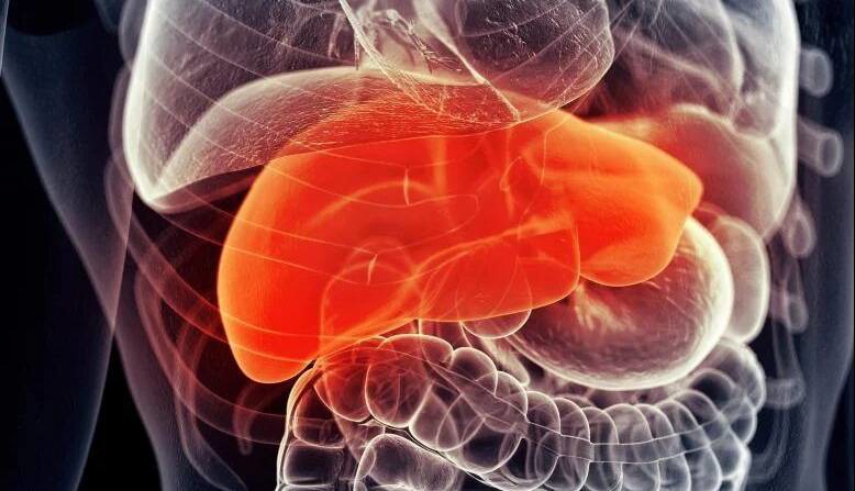 رژیم کم‌پروتئین؛ سپری جدید در برابر سرطان کبد