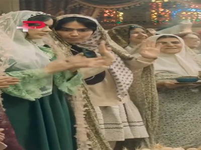 بازیگر بامداد خمار: مجبور شدم کامپوزیت‌های دندانم را بردارم