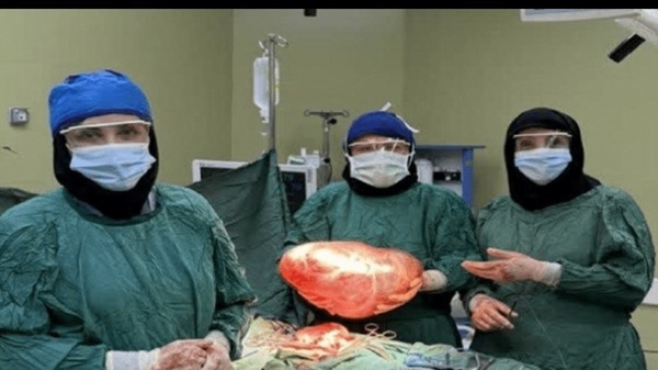 خروج توده ۹ کیلویی از بیمار ۴۹ ساله در شهرکرد