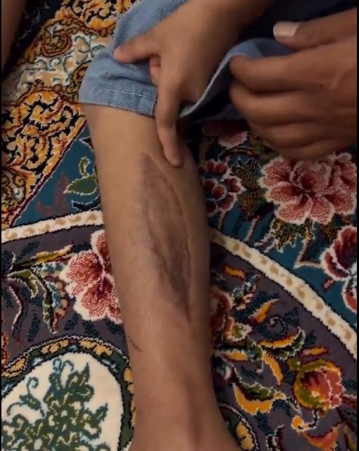 قصه امیرحسین؛ کلاس اولیِ یک خانواده داغدار