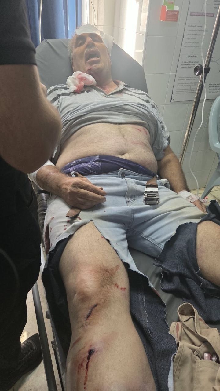حملات وحشیانه شهرک نشینان مسلح صهیونیست به کشاورزان فلسطینی