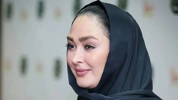 چهره ها/ عکس جدید الهام حمیدی با چهره‌ای که به‌سختی می‌توان شناخت!